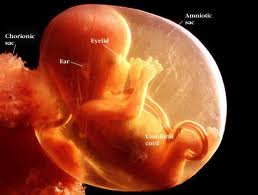 16 week fetus