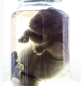 Rhino fetus