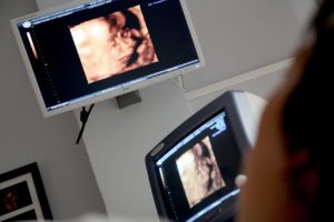 ultrasound detecting fetal abnormalities